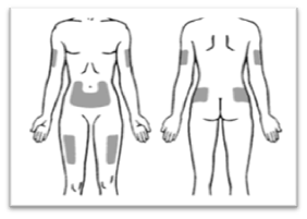 Предпочтительны участки тела для подкожного введения препарата показаны на рисунке
